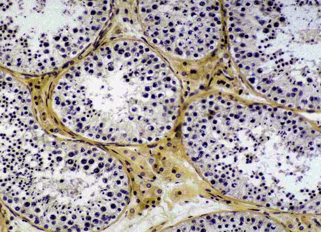 <p><span style="font-size: large">Observe the histological pattern of this specimen and select the correct identification from the list.</span></p><p></p><p><span style="font-size: large">Stain: Iron Hematoxylin and Orange G</span></p><p><span style="font-size: large">a) epididymis</span></p><p><span style="font-size: large">b) ovary</span></p><p><span style="font-size: large">c) prostate gland</span></p><p><span style="font-size: large">d) testis</span></p><p><span style="font-size: large">e) uterus</span></p>