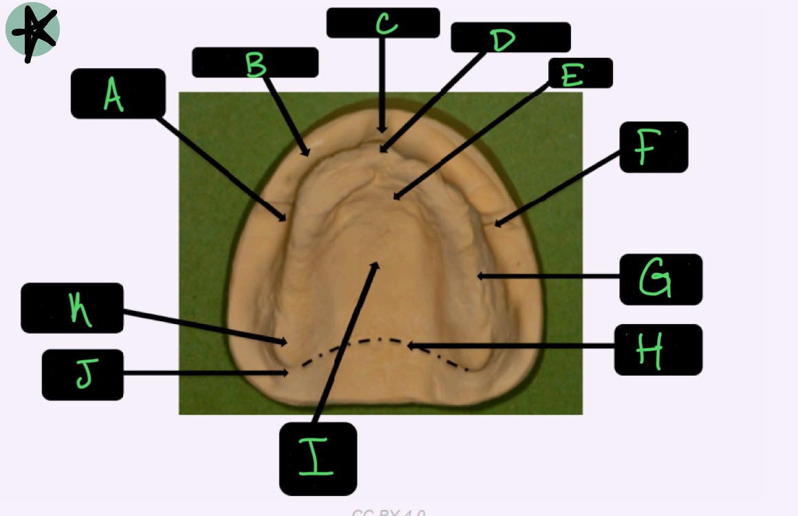 <p>What structure is labeled A?</p>