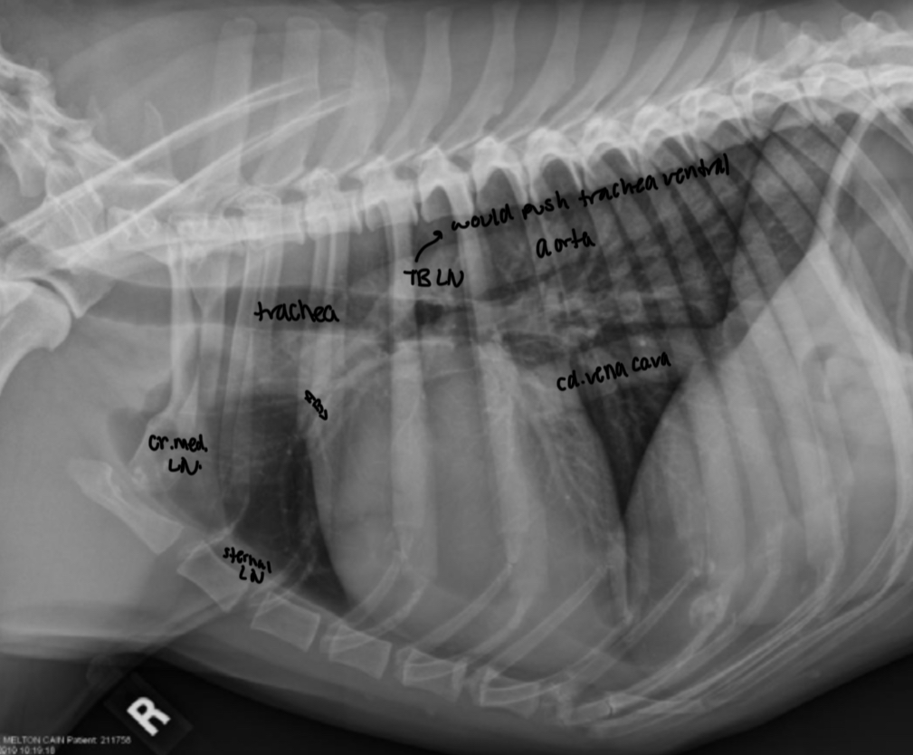 <p>Dorsal 1/3</p><p>- MPA</p><p>- right auricle</p><p>- ascending aorta</p><p>Ventral 2/3</p><p>- wall of right ventricle and outflow tract</p><p></p>