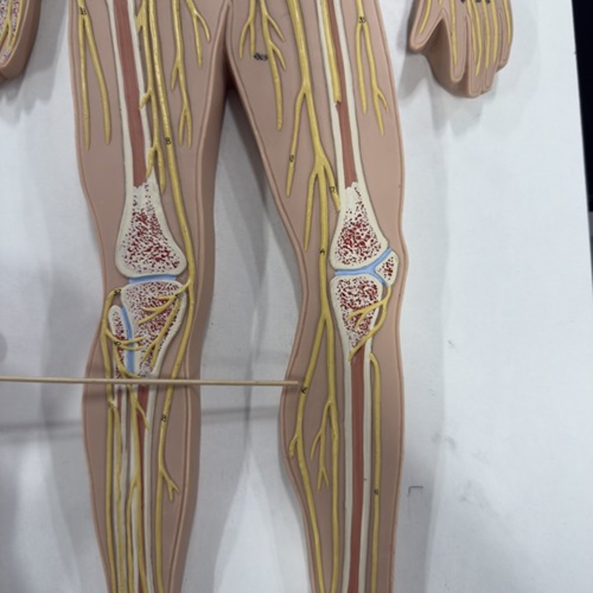 <p>Identify the nerve.</p>