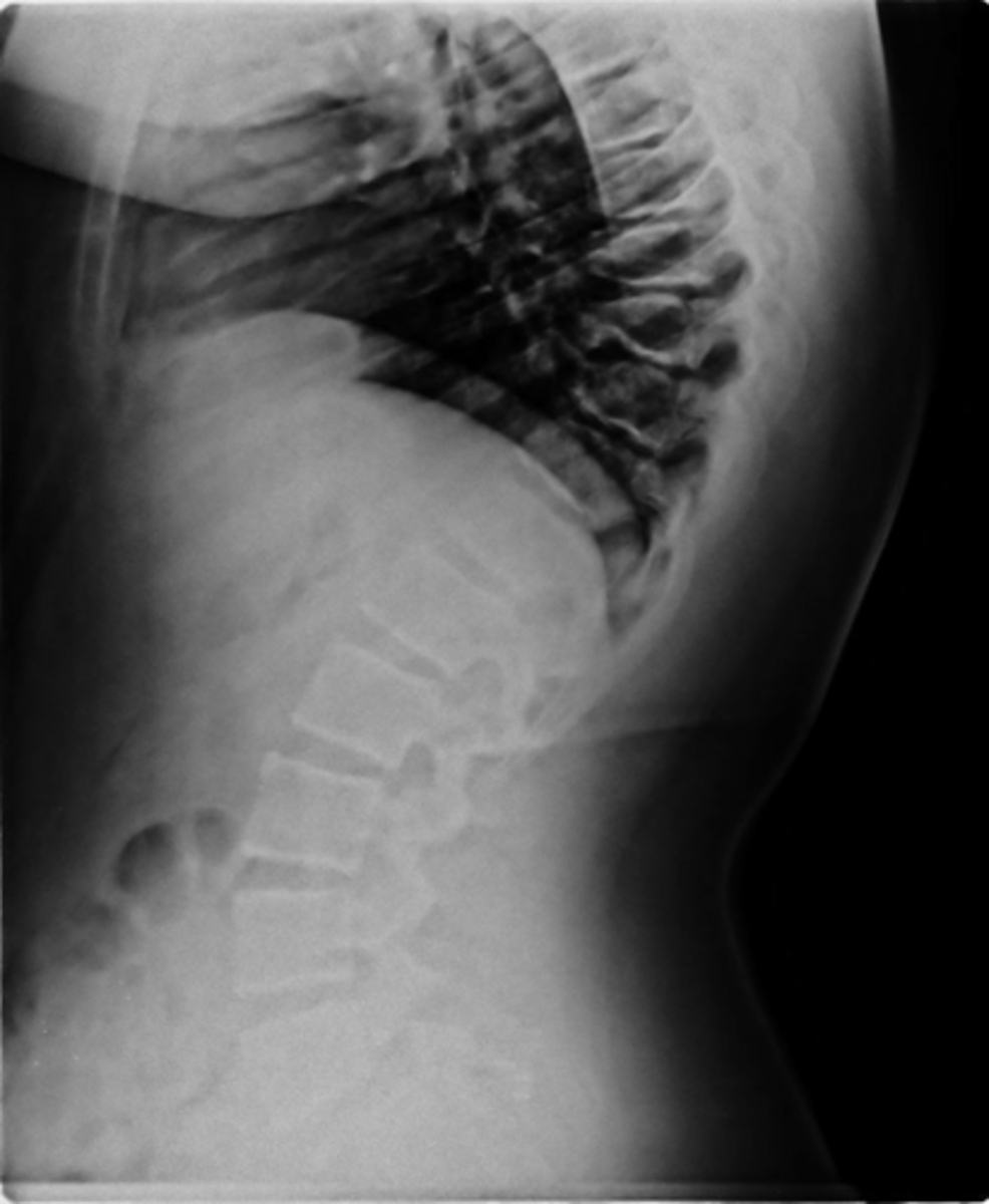 <p>State diagnosis (14 y.o. male)</p>