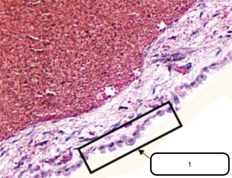 <p>Identify the structure pointed by the arrow.</p>