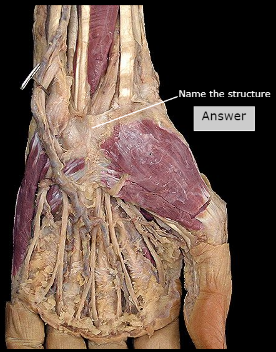<p>What structure is this?</p>