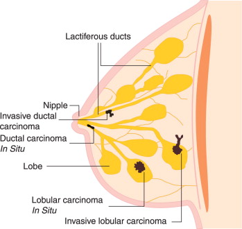 <p>(lo.wi.lob-es)</p>
