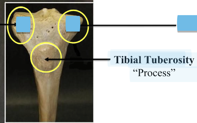 <p>Tibial Tuberosity </p>