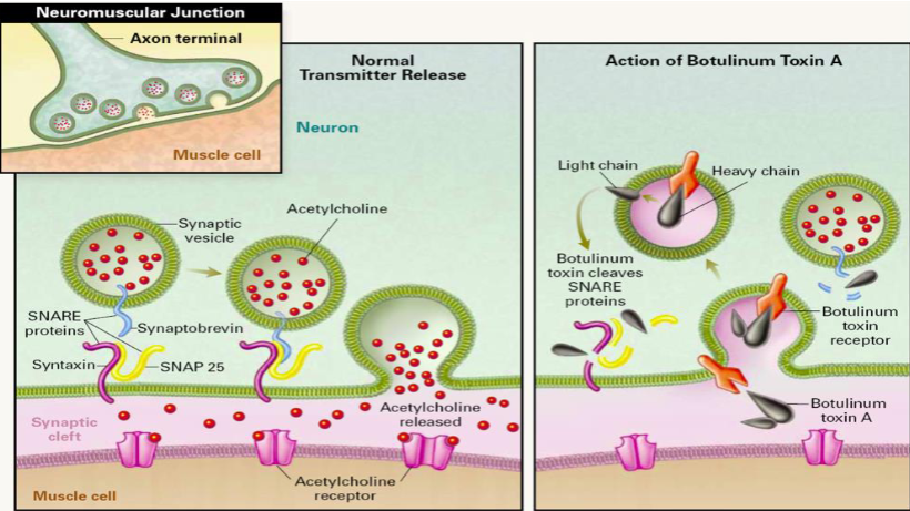 <ul><li><p><span><strong><u>Simple AB toxin</u></strong> that interacts with other bacterial proteins that may protect the AB toxin from stomach acid and proteases, and help it transit the stomach wall</span></p></li><li><p><span>Once in the bloodstream, it is transported to neuromuscular junctions where it binds to glycolipids on the ends of the peripheral nerves</span></p></li><li><p><span>A-portion prevents the release of acetylcholine at peripheral nerve synapses</span></p></li><li><p><span>Nerve impulses can’t be transmitted, no muscle stimulation</span></p></li><li><p><span>Doesn’t kill neurons, just prevents them from functioning</span></p></li></ul><p></p>
