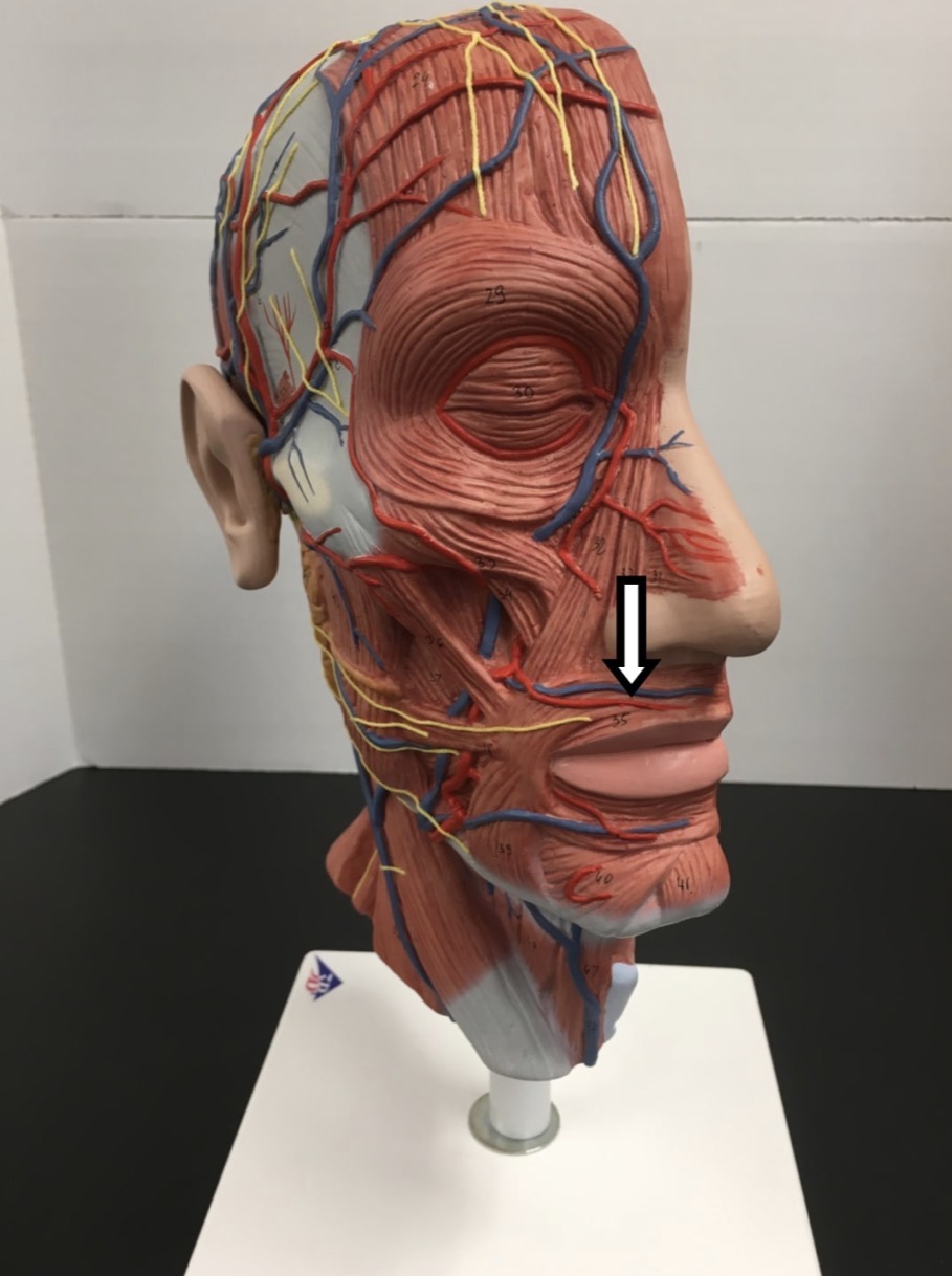 <p><span>Name the muscle labeled with the white arrow below AND name ONE action .</span></p>