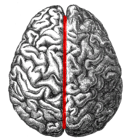 <p>divides left and right side of brain</p>