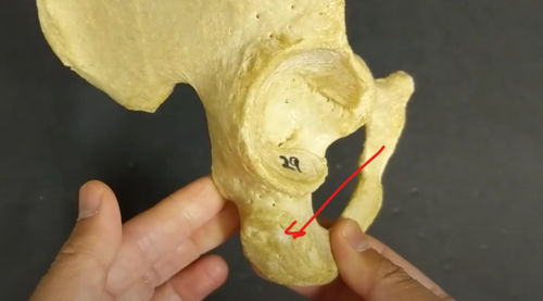 <p>large bumpy region of the ischium </p>