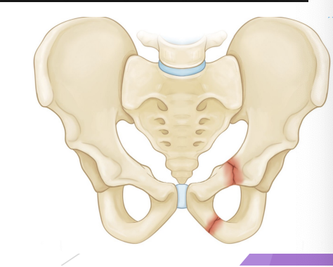 <p>Pelvis</p>