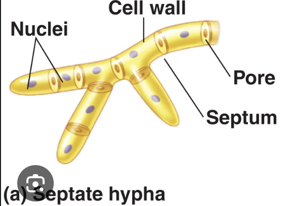 <p>Septate (Has walls)</p>