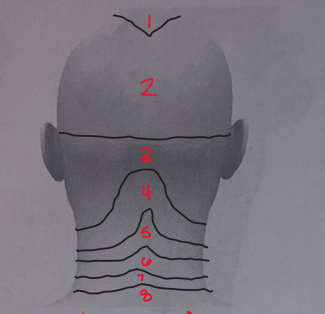 <p>What is number 6?</p>