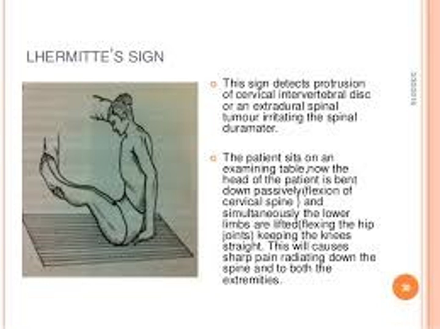 <p>Dysfunction of spinal cord and/or an upper motor neuron lesion</p>