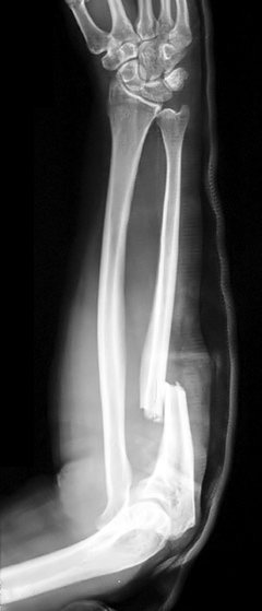 <p>Describe the abnormality demonstrated. </p>