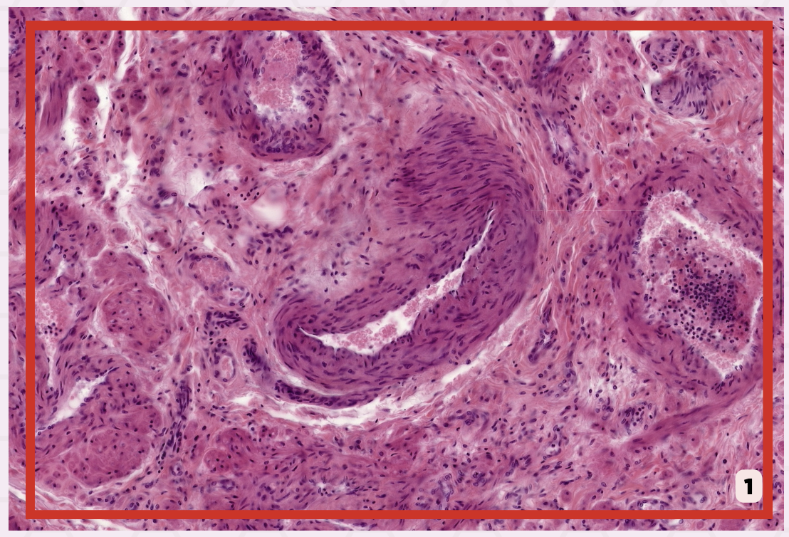 <p>Identify the structure labeled as 1.</p>