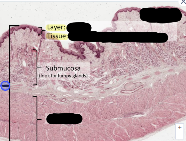 <p>what is this a histology of?</p>