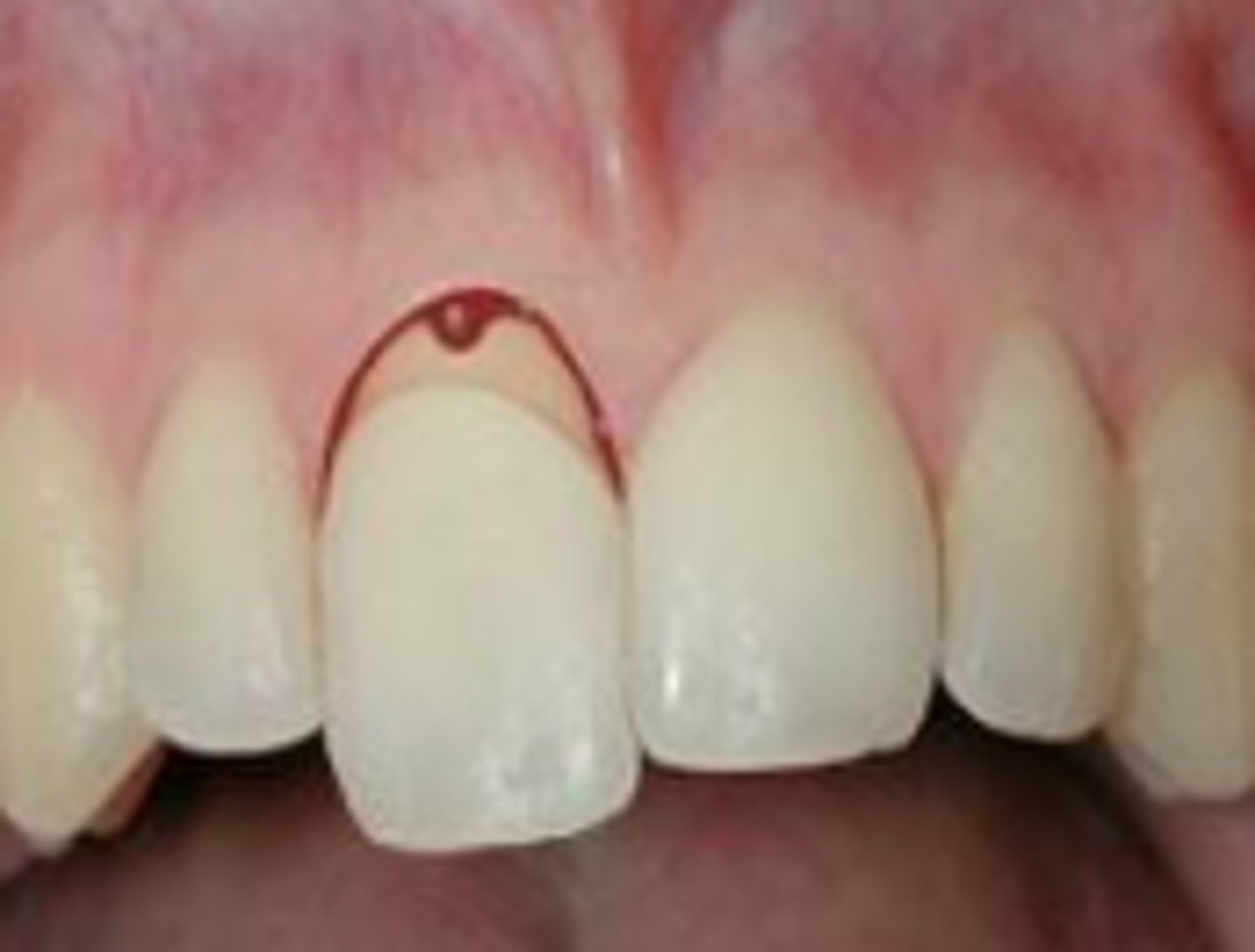 <p>Which trauma:</p>