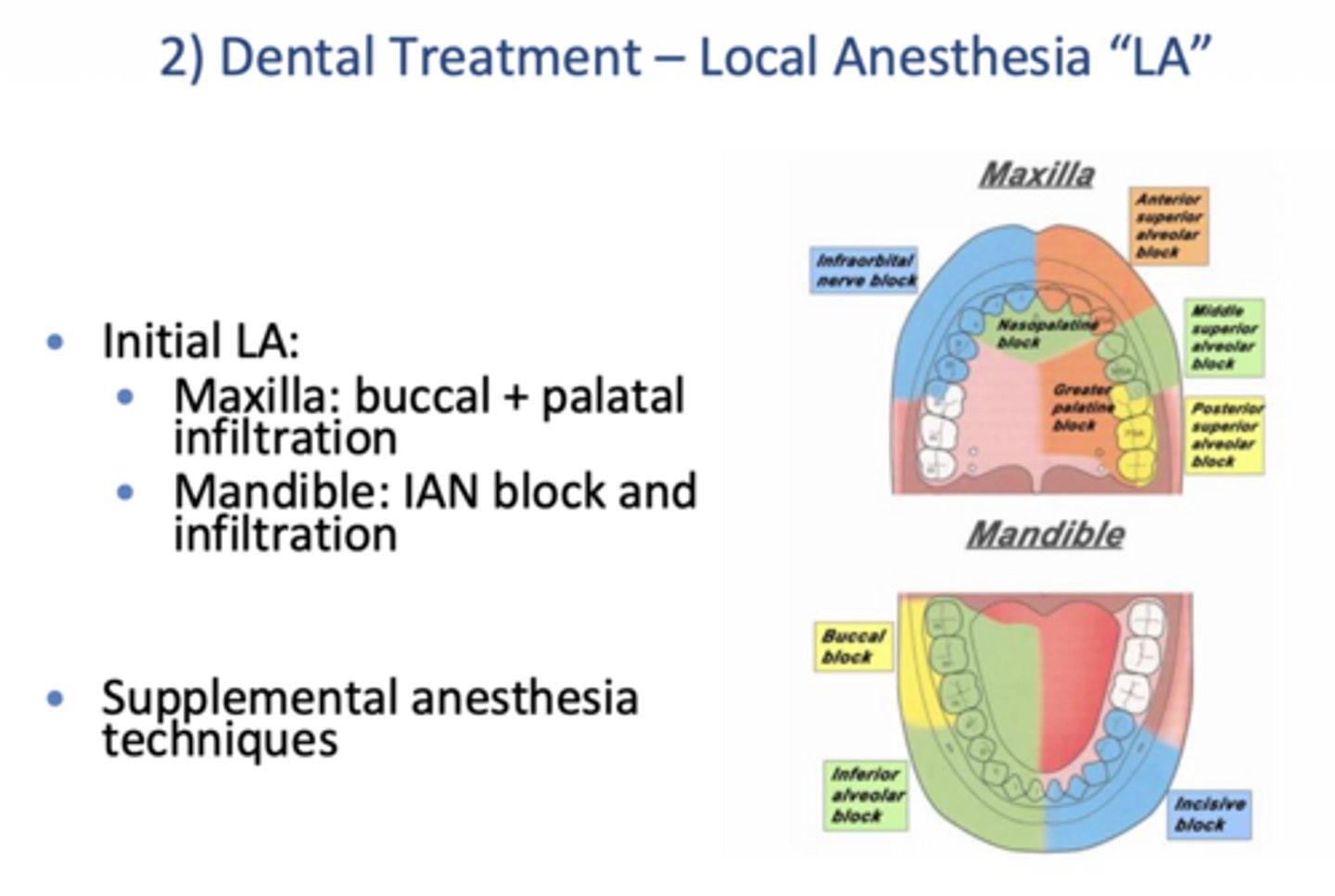 <ol><li><p>Initial LA</p><ol><li><p>Maxilla: buccal + palatal infiltration</p></li><li><p>Mandible: IAN block and infiltration</p></li></ol></li><li><p>Supplemental techniques</p></li></ol><p></p>
