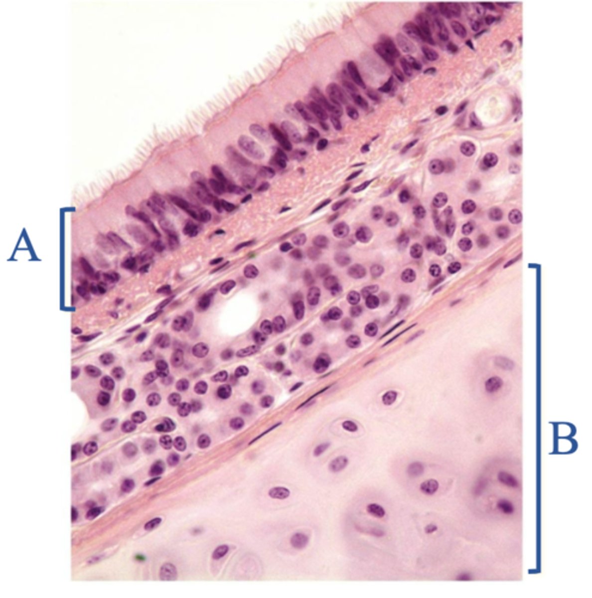<p>Name the tissue at A</p>