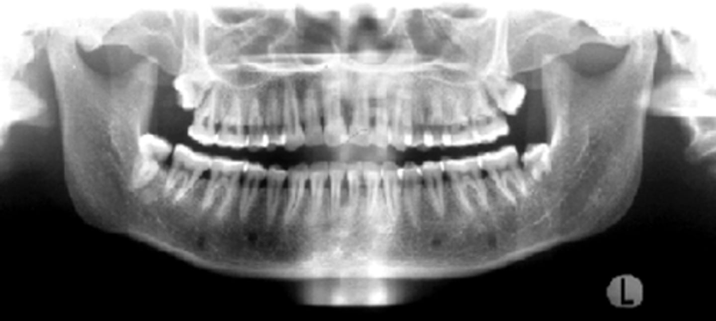 <p>ID the positional error from the radiograph:</p>
