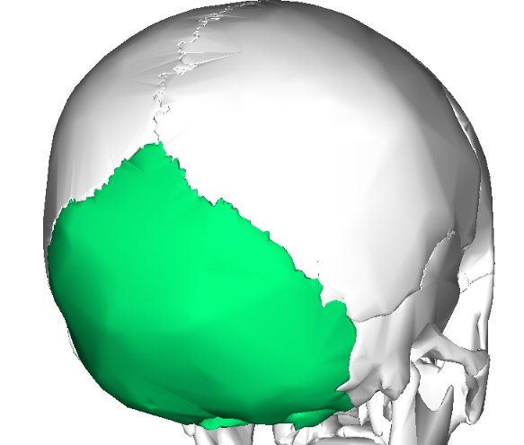 <p>What is the name of this bone in the skull?</p>