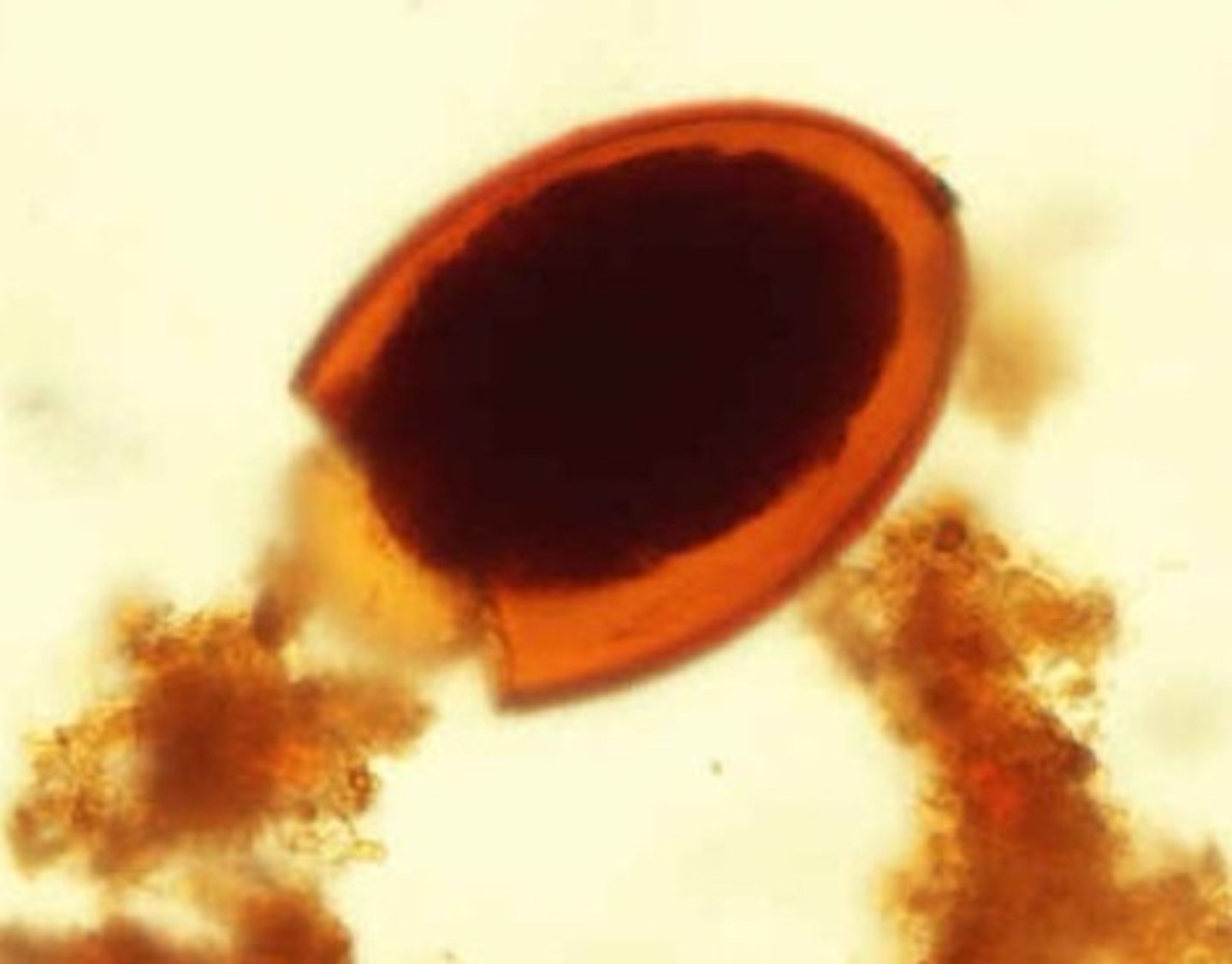 <p>Identify the parasite</p>