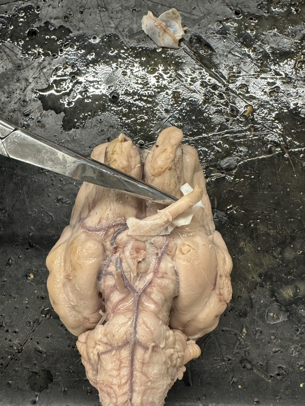 <p>what nerve is this?</p>