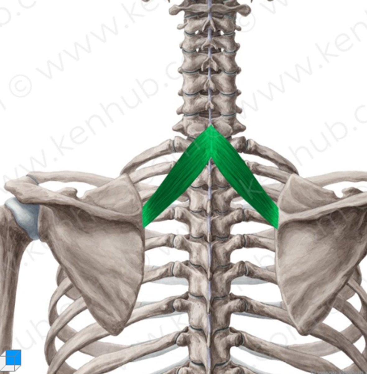 <p>Welke spier is dit?</p>