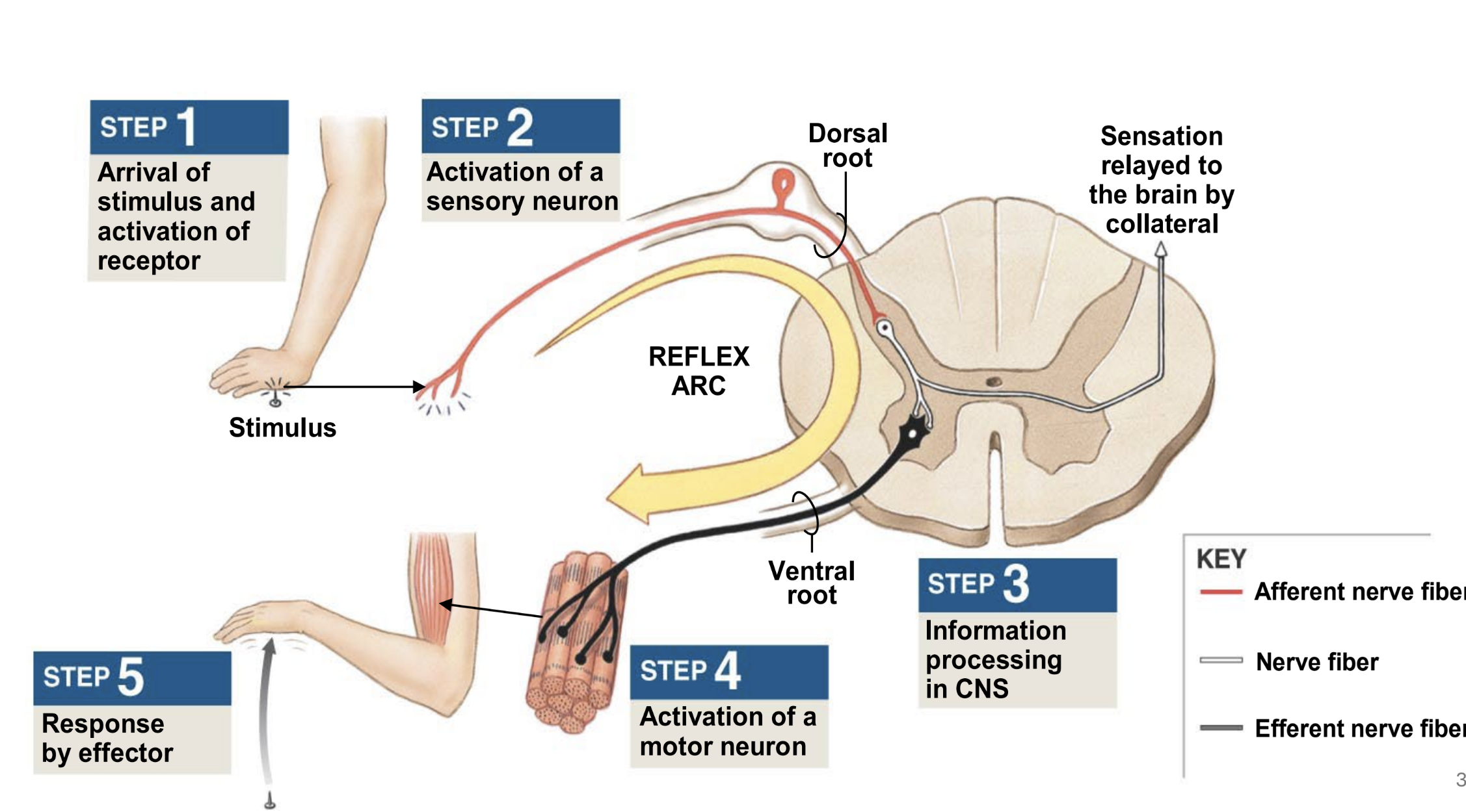 <ol><li><p>pain receptor responds to stimulus and initiates impulse</p></li><li><p>sensory neuron in dorsal root ganglion transmits impulse to cns (spinal cord)</p></li><li><p>interneuron links between sensory and motor neurons</p></li><li><p>motor neuron in ventral gray horn of spinal cord transmits impulse from cns to pns (via spinal nerve)</p></li><li><p>effector — skeletal muscle responds to motor neuron impulse</p></li></ol><p></p>