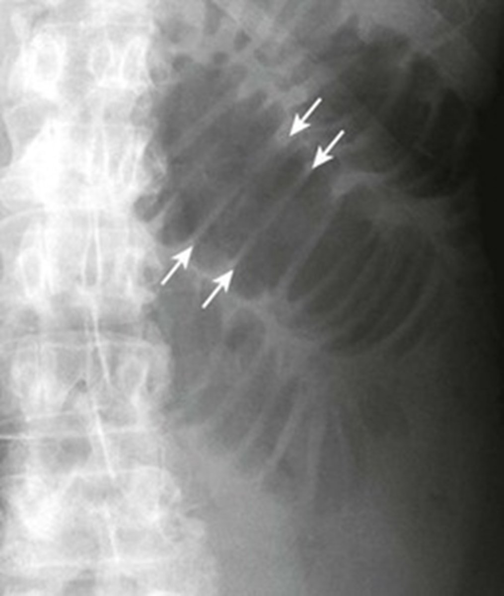 <p>What are the white arrows pointing to?</p>