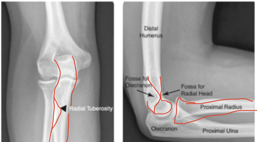 <p>Normal elbow</p>