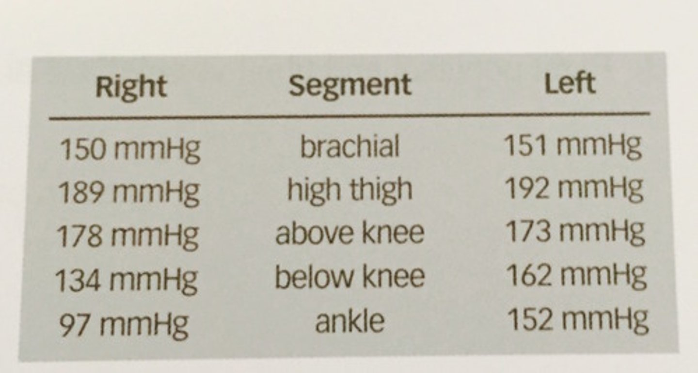 <p>281. (Peripheral arterial measurement techniques)</p><p>Evaluate the segmental pressures presented. What is the most likely reason for the horizontal difference of 28mmHg at the level below the knee?</p><p>a. right inflow disease</p><p>b. cuff artifact</p><p>c. left femoral artery disease</p><p>d. right popliteal and tibial vessel disease</p>