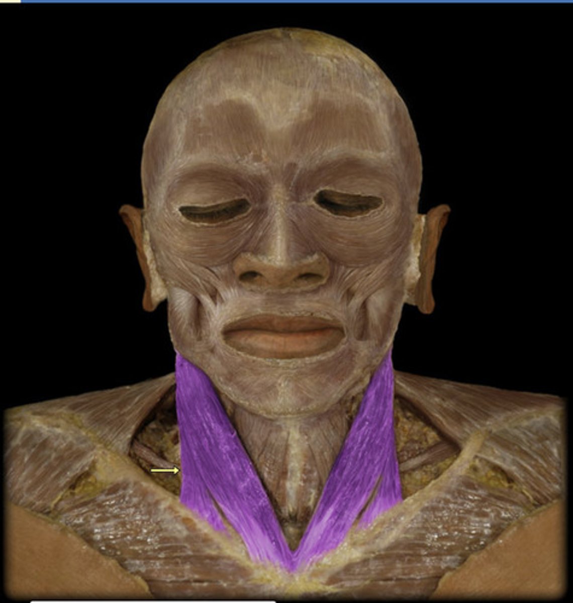 <p>sternocleidomastoid</p>