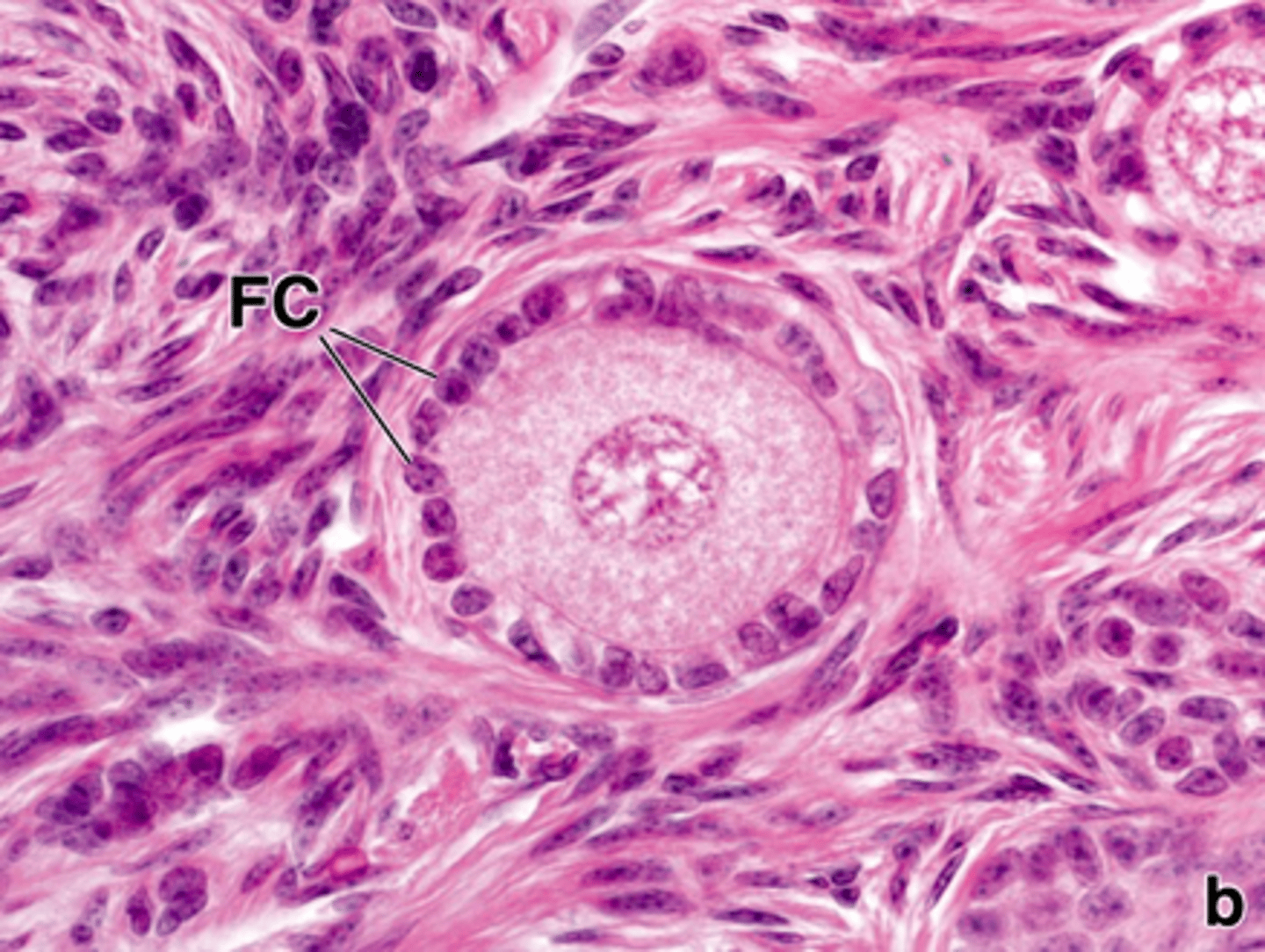 <p>ID the ovarian cell stage:</p>