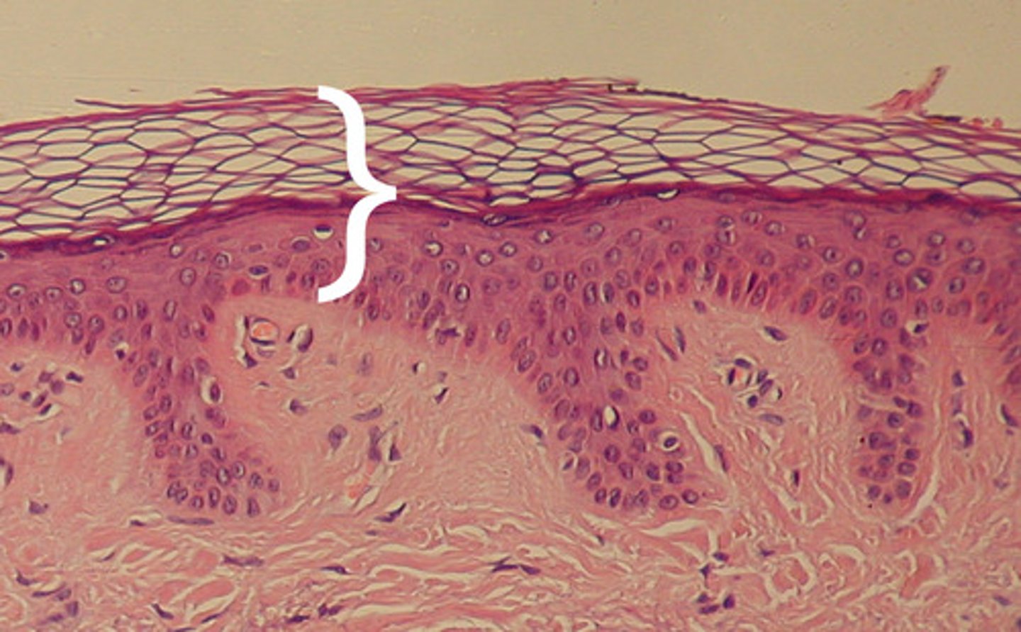<p>keratinized stratified squamous epithelium</p><p>cells: keratinocytes, melanocytes, merkel cells, Langerhans cells</p>