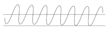 <p>Welke ademhaling zie je hier</p>