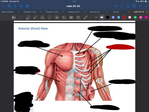 <p>What muscle is this?</p>