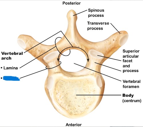 <p>which part of the vertebrae?</p>