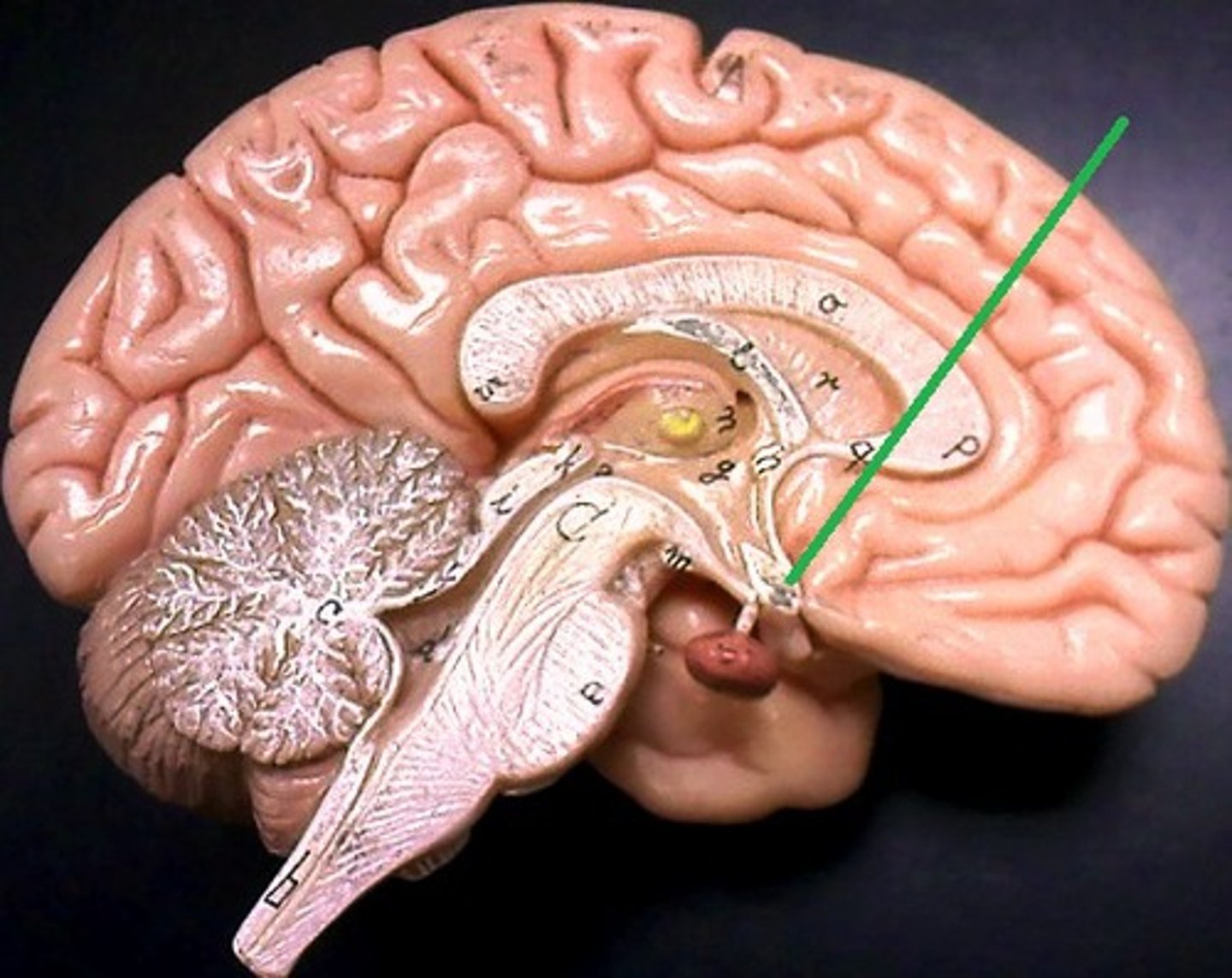 <p>point at which optic nerve fibers cross in the brain</p>