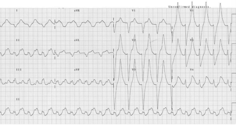 <p>What does this indicate</p>