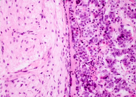 <ul><li><p>Posterior Lobe is made of neural tissue.</p></li><li><p>Anterior Lobe is made of glandular tissue</p></li></ul><p></p>