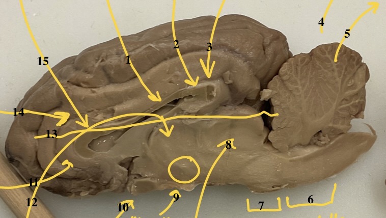 <p>3 (underneath tissue due to cut)</p>