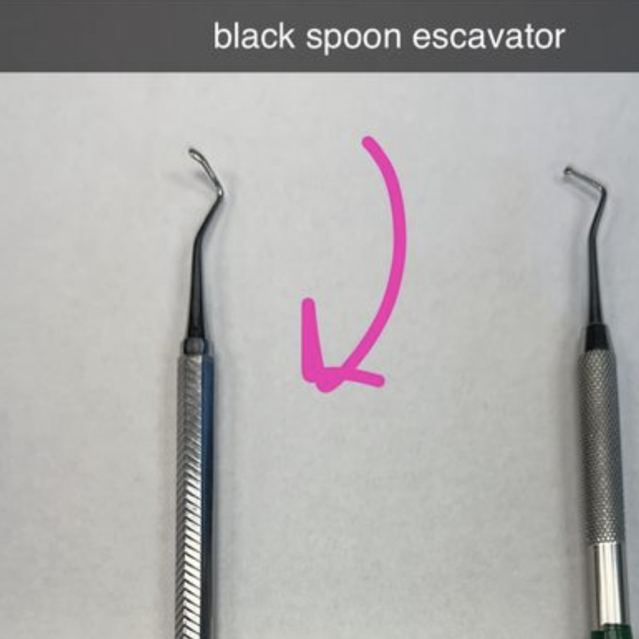 <p>BLACK SPOON ESCAVATOR</p>