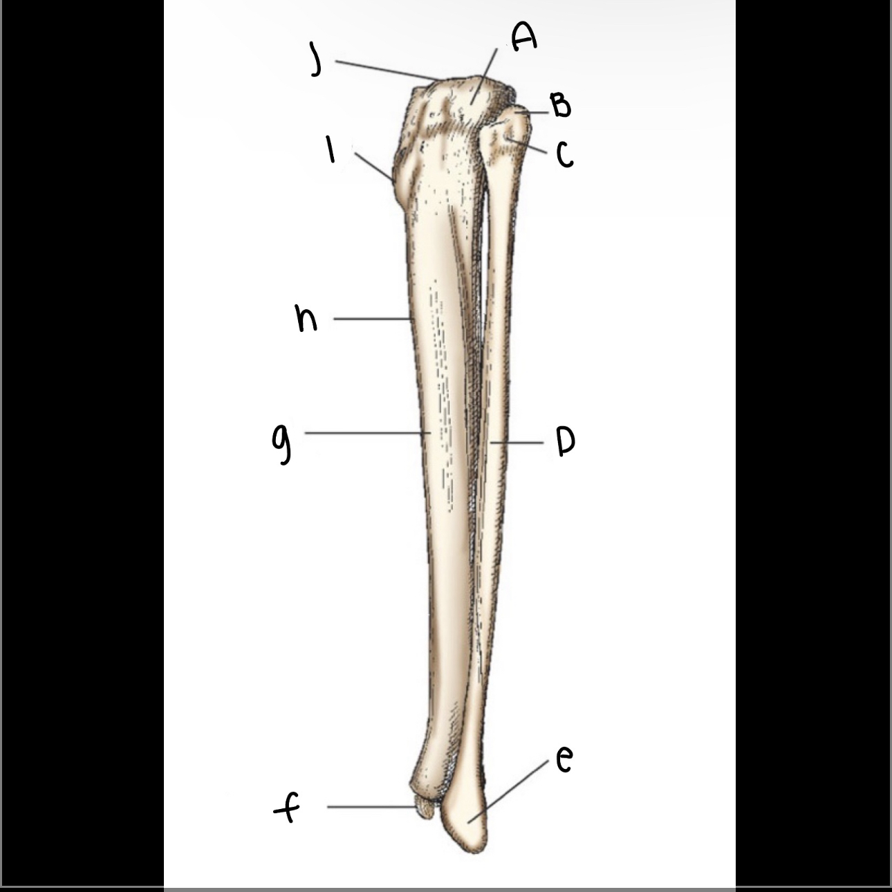 <p>What is letter C pointing to?</p>