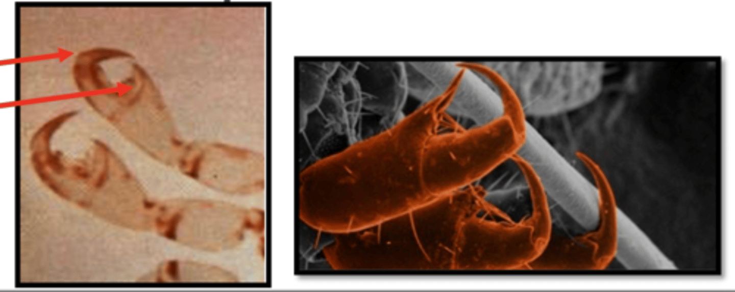 <p>which insect has this very specific tibial pad and tarsal claw that make it specific for a host's hair?</p>