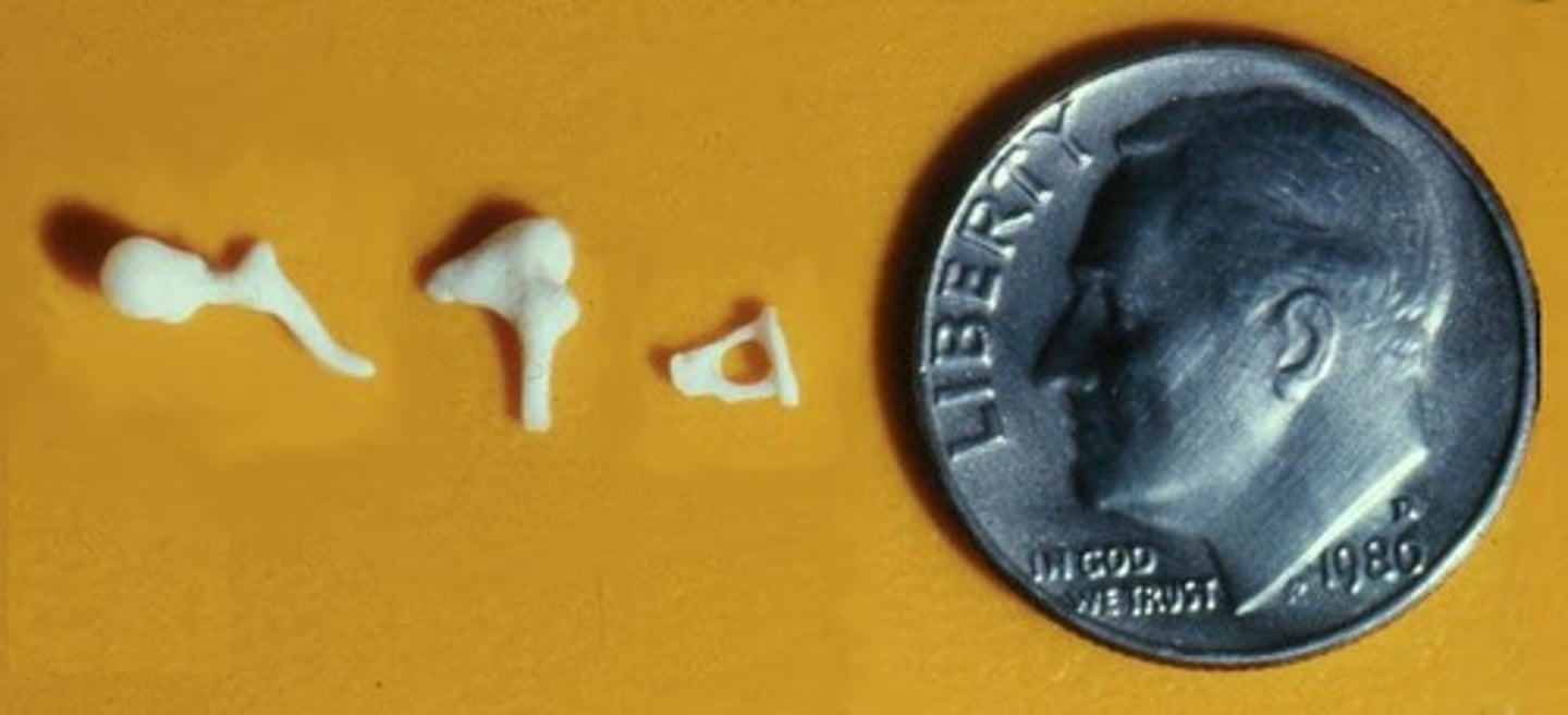 <p>Malleus (Hammer), Incus (Anvil), Stapes (Stirrup)</p>