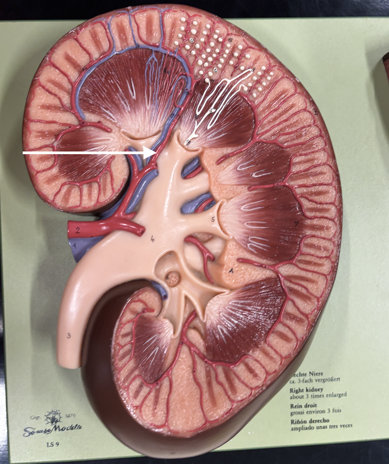 <p>what structure is the arrow pointing to? *artery*</p>