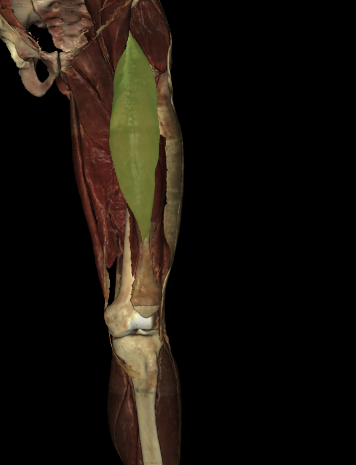 <p>Identify the Structure</p>