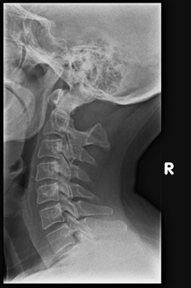<p>State diagnosis</p>