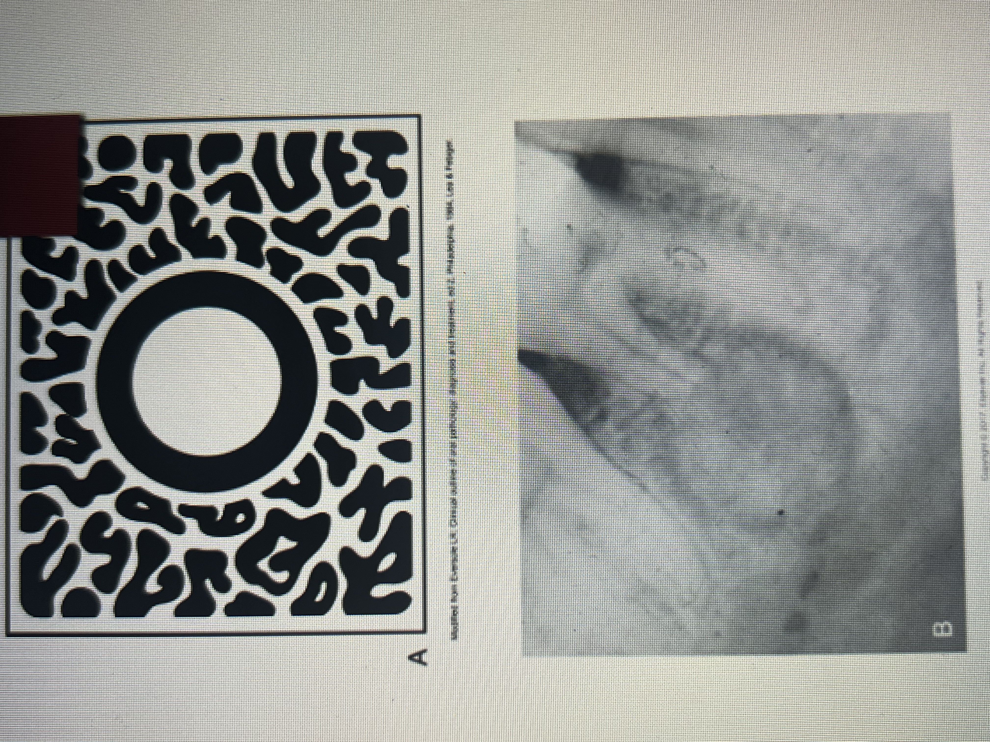 <p>Target lesion</p>